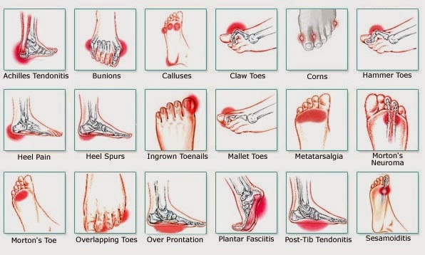 sakit di tumit kaki