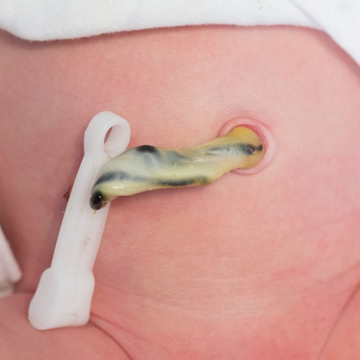 Cara Kendalikan Baki Tali Pusat Bayi Baru Lahir November 2021 Kelabmama Malaysia