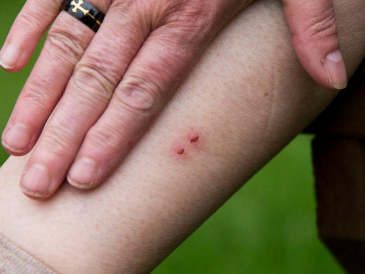 Apa Yang Mama Papa Harus Tahu Jika Dipatuk Ular November 2021 Kelabmama Malaysia