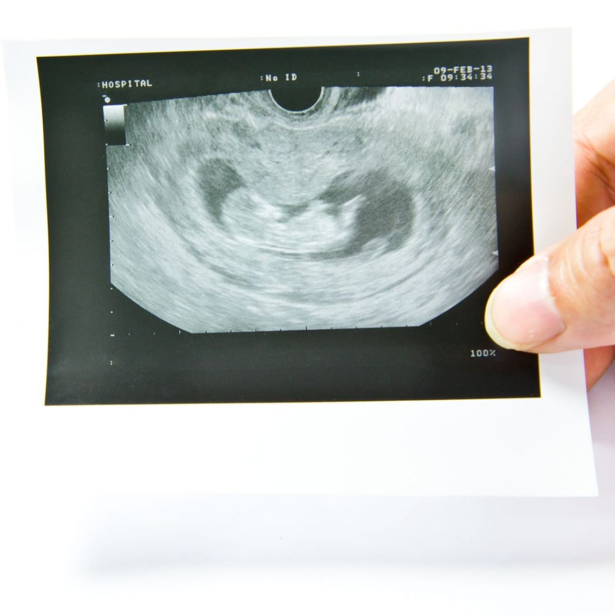 Bila Doktor Akan Scan Kandungan Anda June 2021 Kelabmama Malaysia