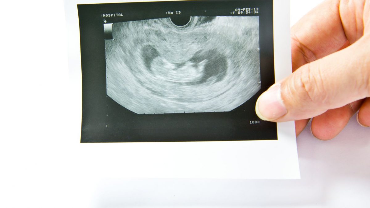 5 Tips Untuk Membetulkan Bayi Songsang Di Dalam Kandungan Secara Semulajadi