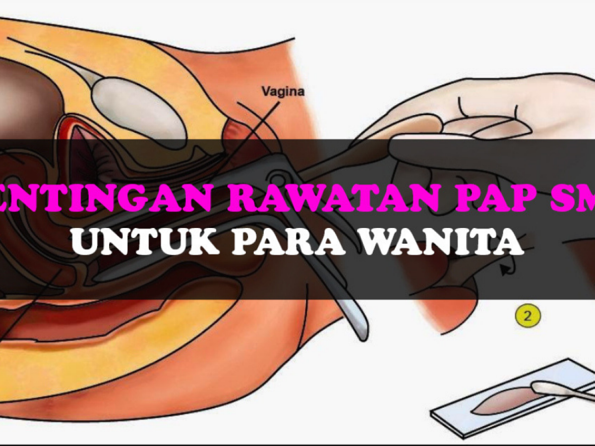 Kepentingan Rawatan Pap Smear Untuk Setiap Wanita November 2021 Kelabmama Malaysia