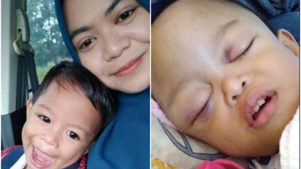 Ibu Tak Sangka Terhantuk Biasa Menyebabkan Bayi Alami Pendarahan Di Kepala