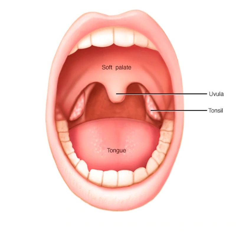 Jangkitan Pada Tonsil Sering Menyerang Si Manja