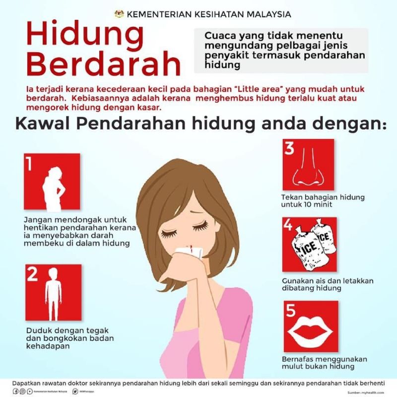 Hidung Berdarah? Ini Cara Hentikan Pendarahan