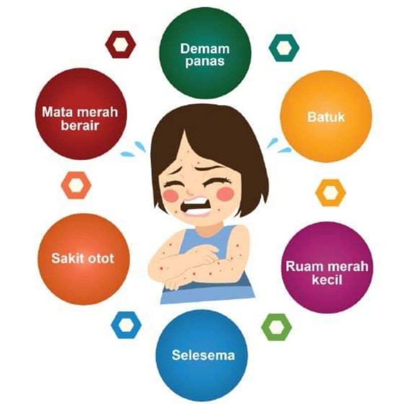 Virus Measles Buat Badan 'Lupa' Cara Lawan Penyakit