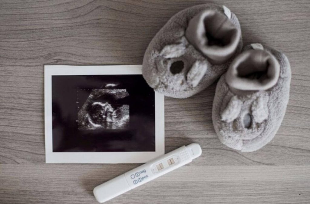 Alat ujian hamil dan gambar sonogram