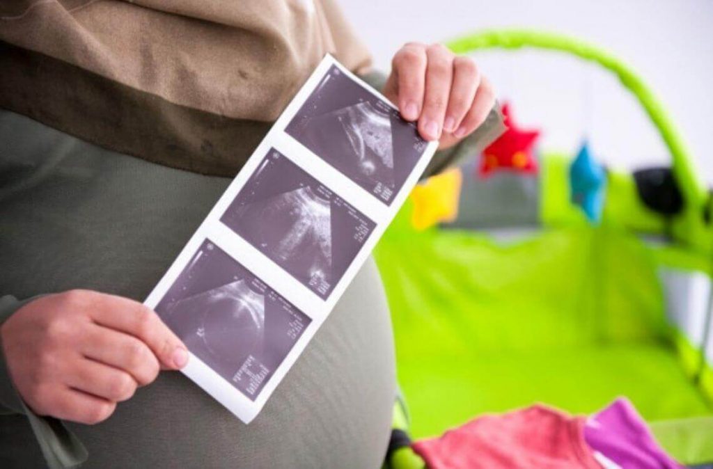 Ibu mengandung menunjukkan gambar scan baby