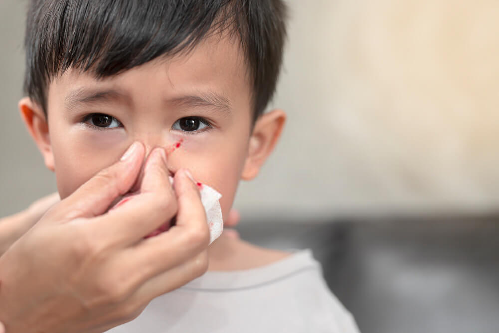 budak hidung berdarah disebabkan oleh resdung