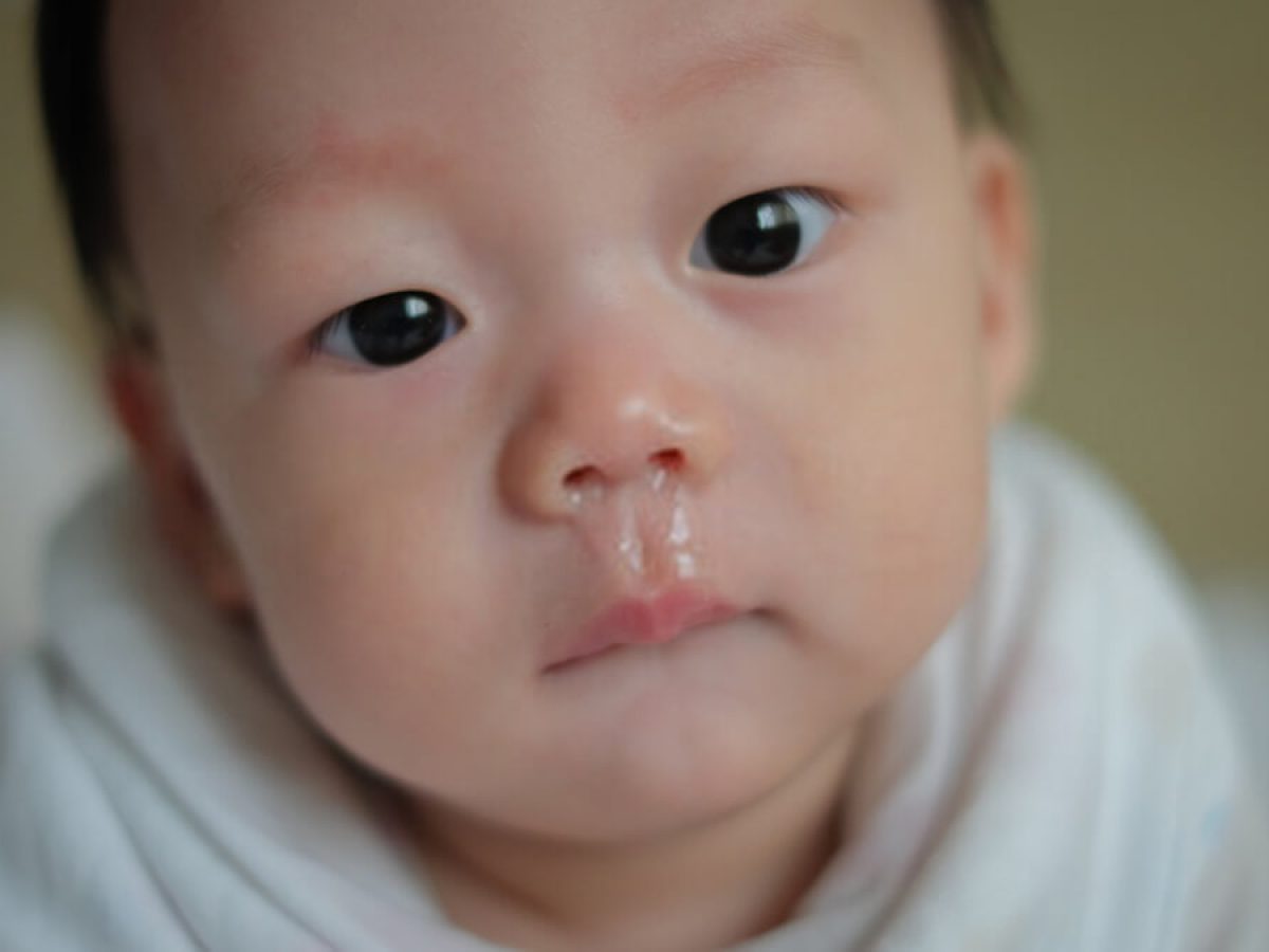 Cara hilangkan batuk berkahak bayi