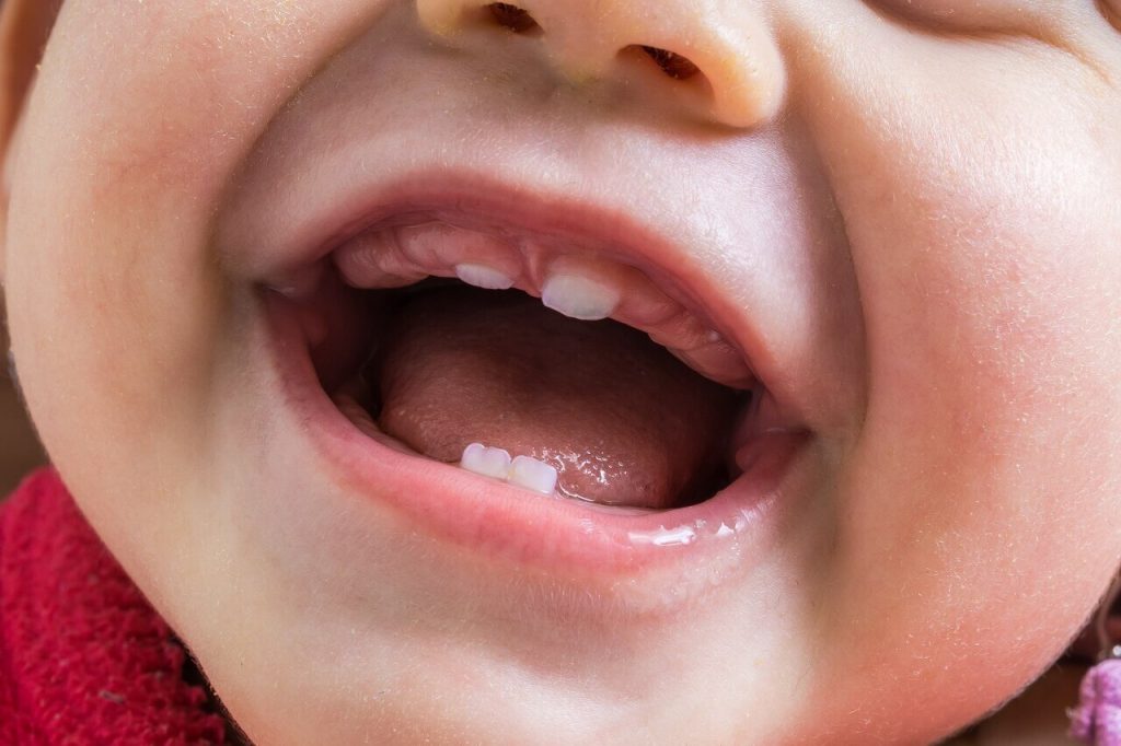 tumbuh gigi juga boleh membuatkan suhu demam bayi naik