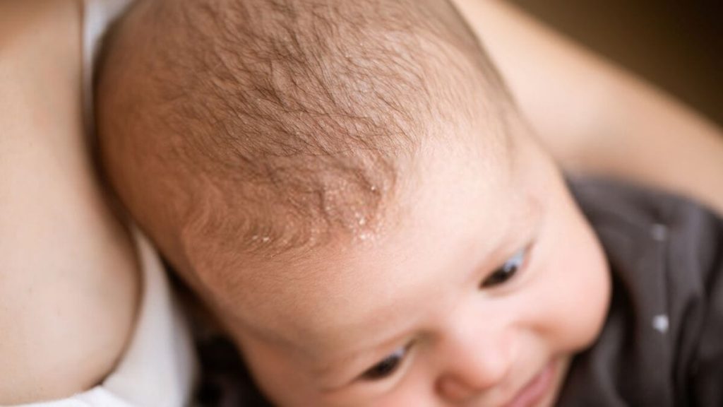 cukur rambut bayi