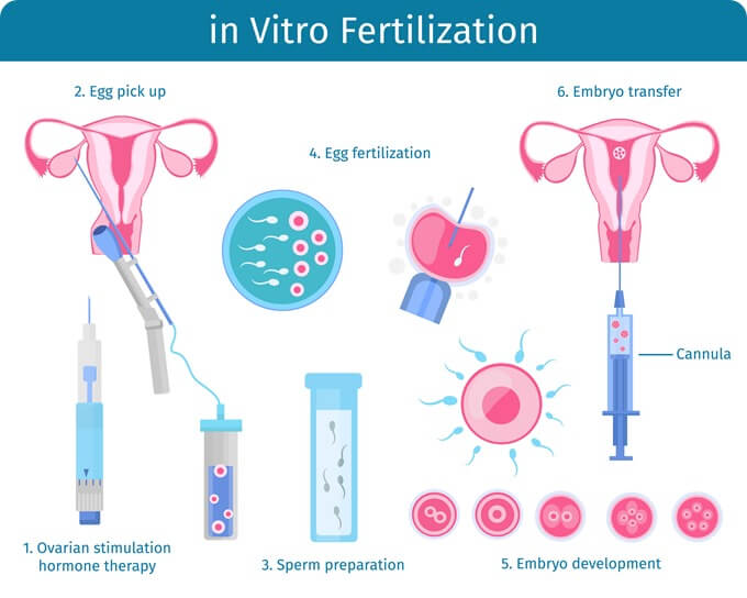 IVF hospital kerajaan 