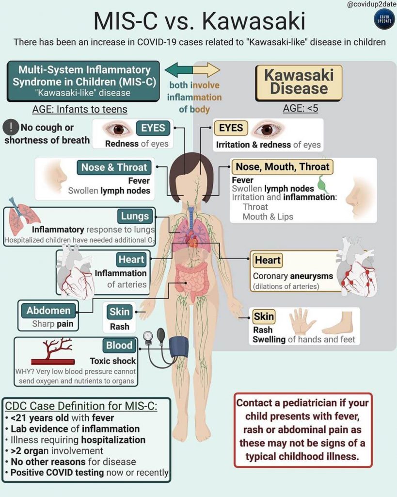 MIS-C komplikasi jika tidak vaksin pada anak-anak