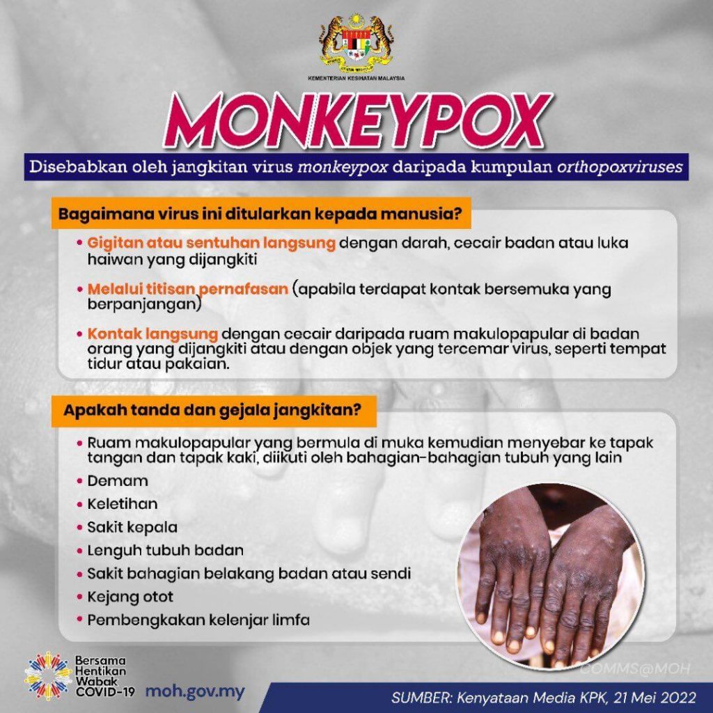 monkeypox