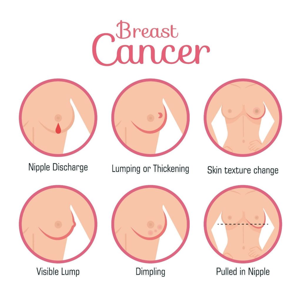 barah payudara daripada pemeriksaan mamogram