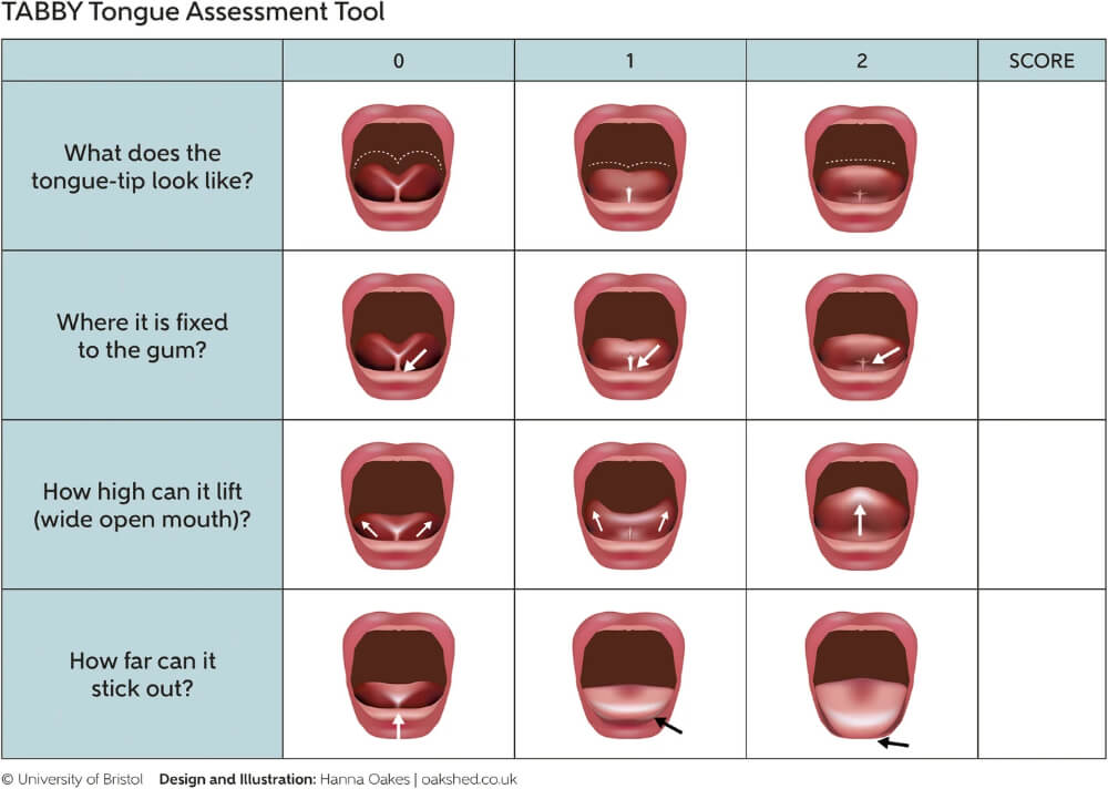 lidah pendek assessment tool 