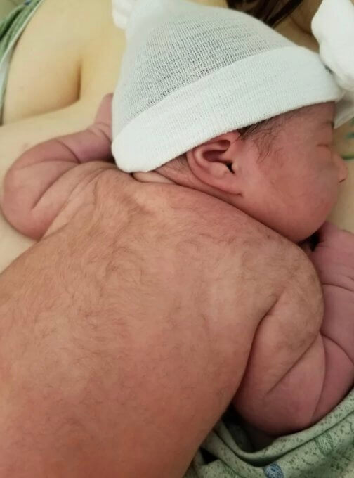 badan bayi berbulu merupakan antara perkara aneh tentang newborn