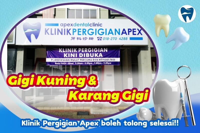 klinik gigi alor setar - klinik pergigian Apex