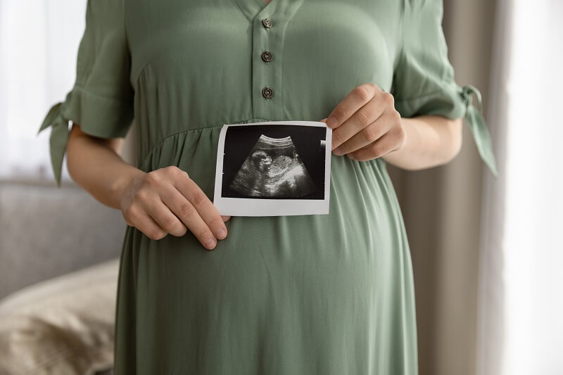 ibu hamil memegang gambar ultrasound baby