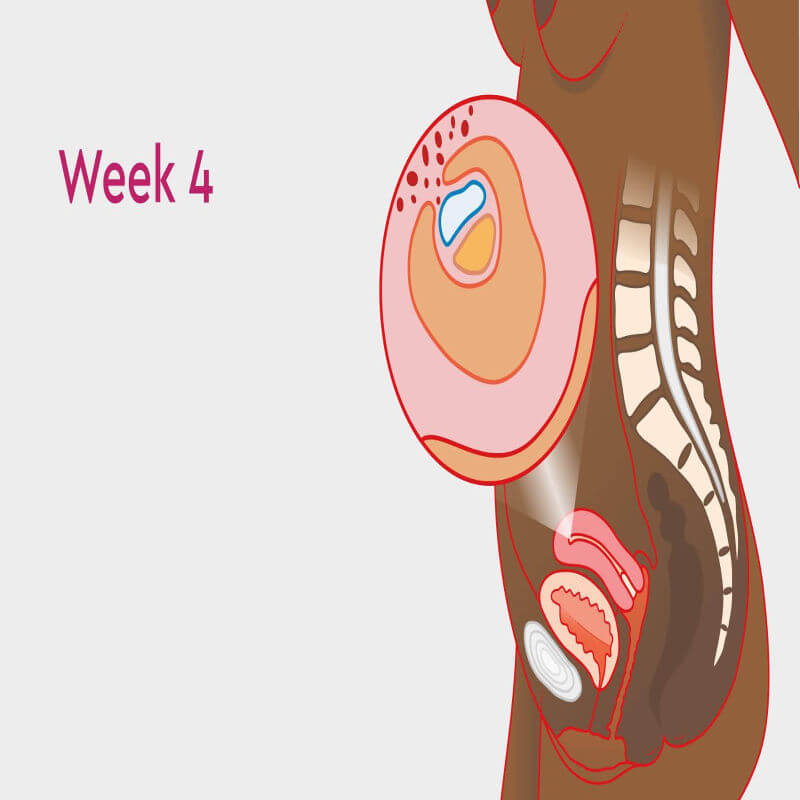 hamil 4 minggu
