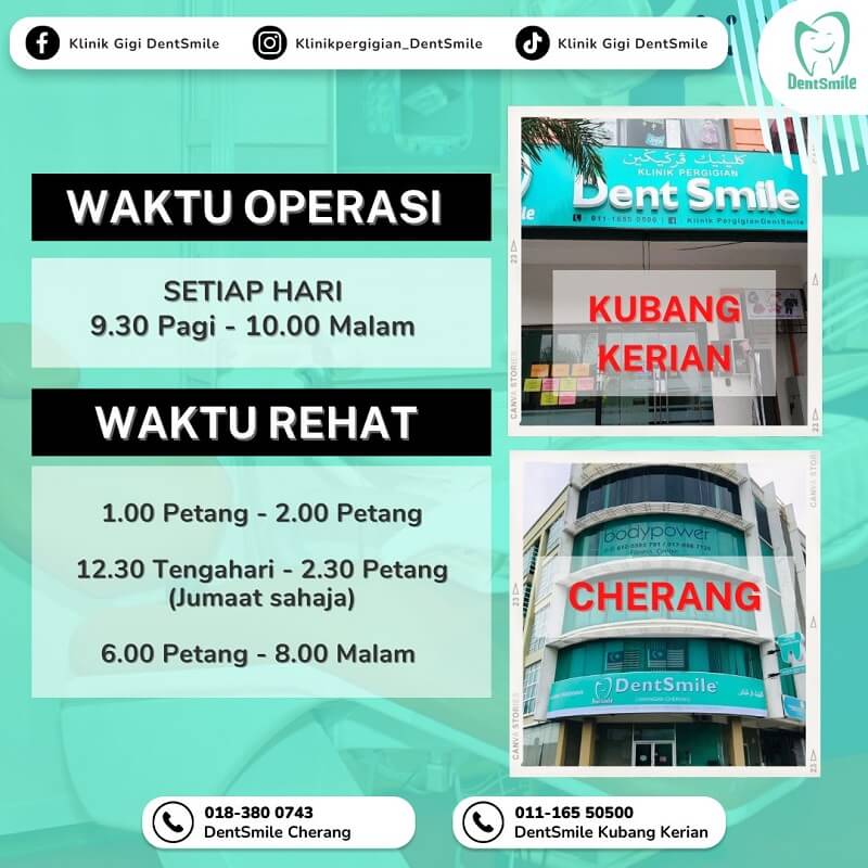 klinik gigi di kota bharu - Klinik Gigi DentSmile Kota Bharu