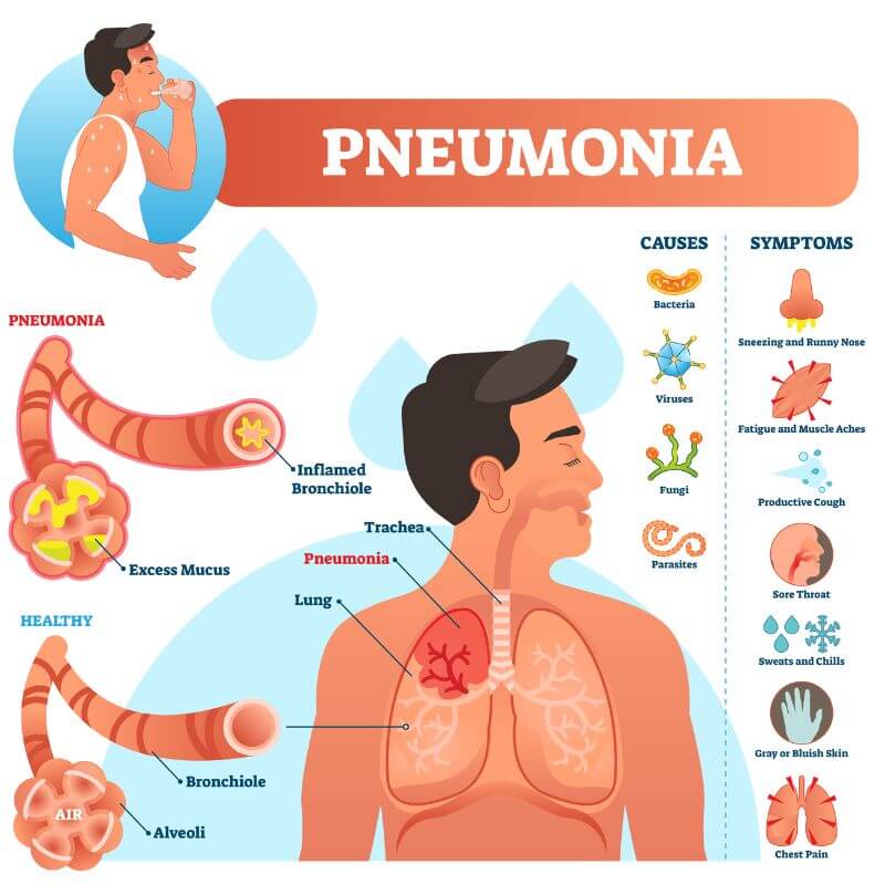 penyakit pneumonia china
