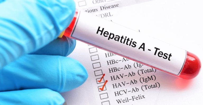 Hepatitis A merupakan salah satu penyakit bawaan air