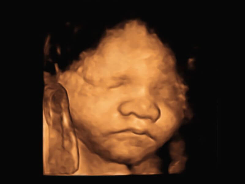 scan bayi 3D 4D 5D