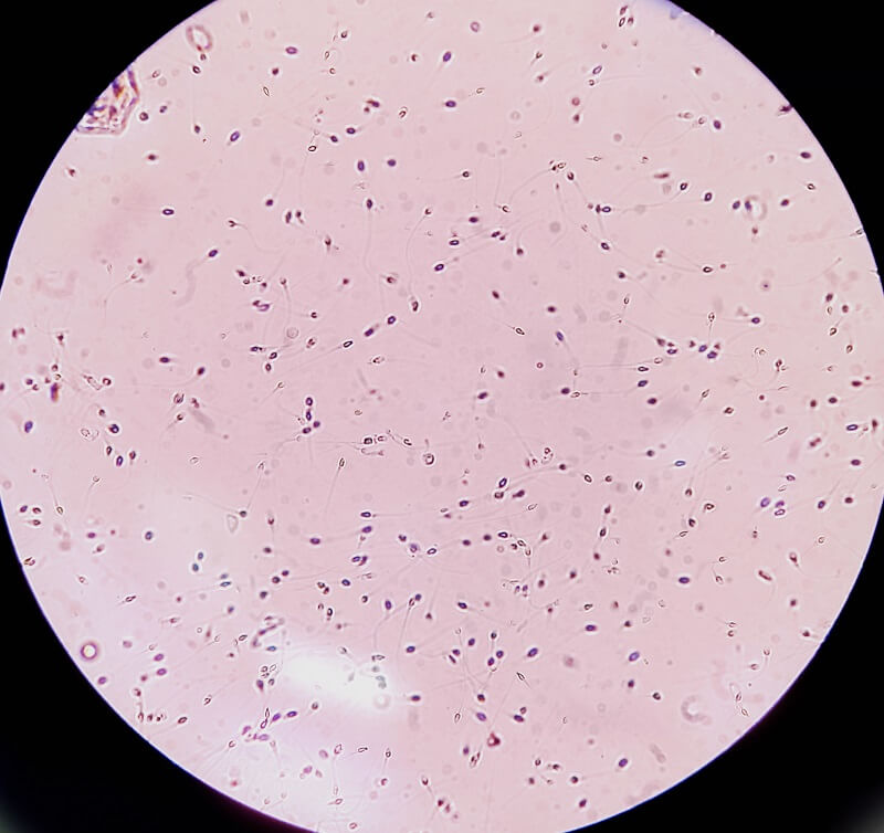 analisis sperma di bawah mikroskop