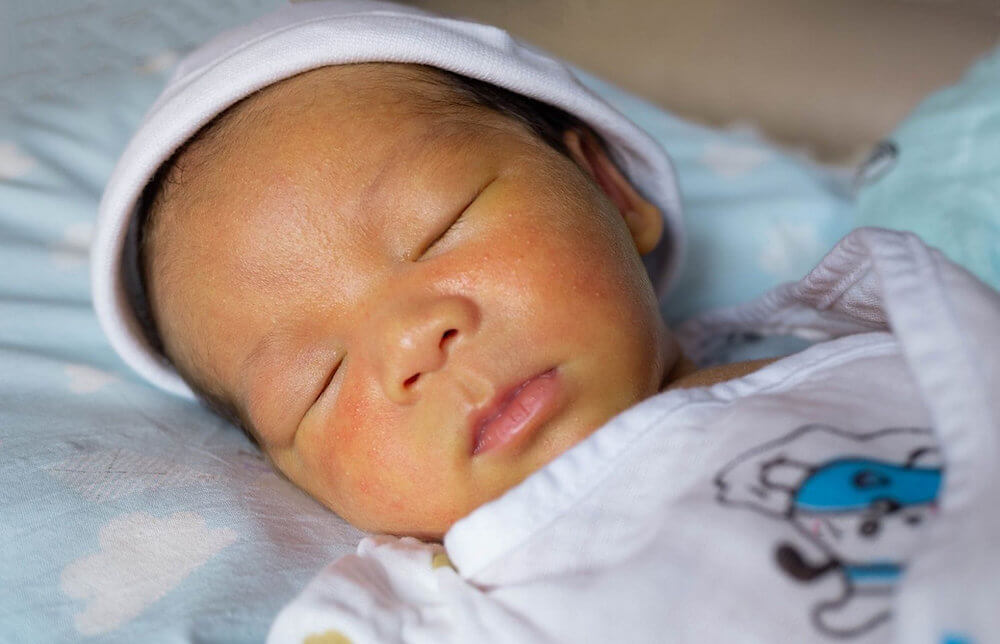 pokok susu nabi untuk kuning bayi atau jaundis