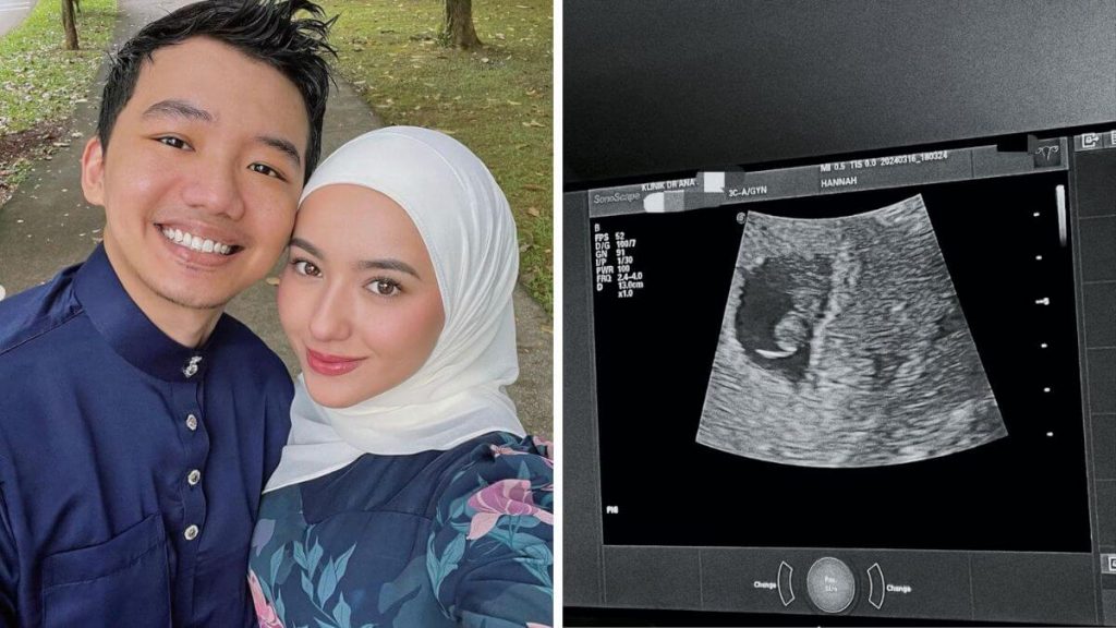 In Shaa Allah jumpa di syurga nanti sayang... Luah Hannah Delisha Kali Pertama Keguguran