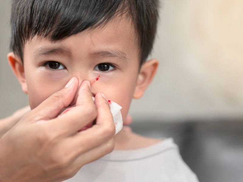 Punca Hidung Berdarah bagi Kanak-kanak