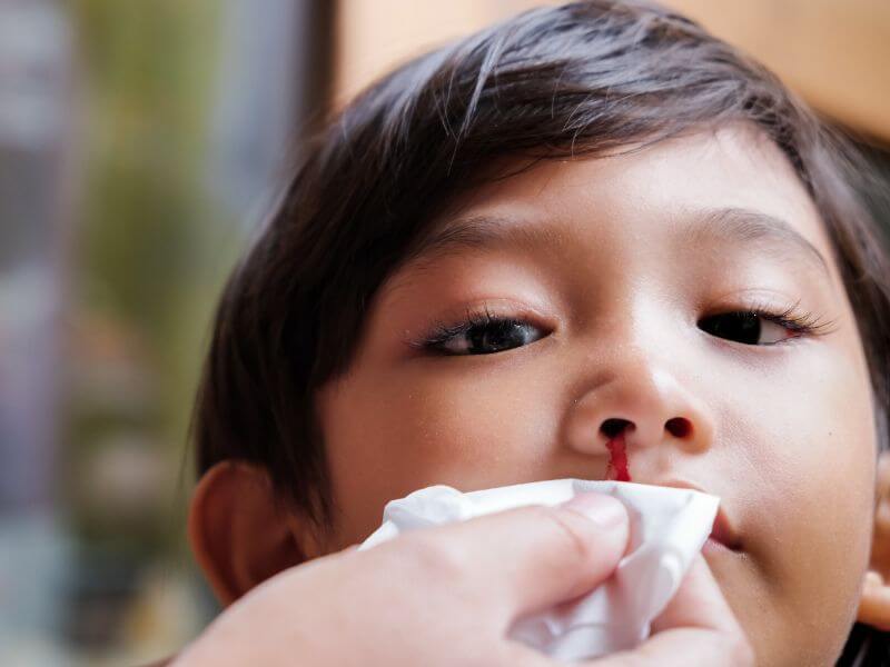 Punca Hidung Berdarah bagi Kanak-kanak