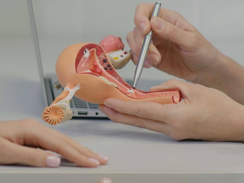Kanser Endometrium