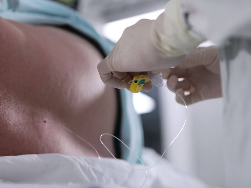 epidural semasa bersalin