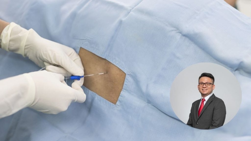 penjelasan epidural