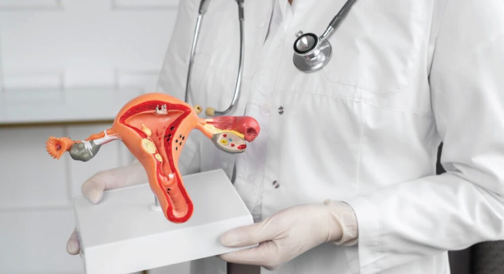 Kanser Endometrium