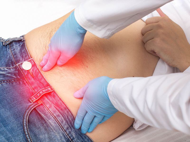 hernia pada lelaki